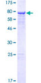 SAMD11 Protein - 12.5% SDS-PAGE of human SAMD11 stained with Coomassie Blue