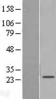 SAMD12 Protein - Western validation with an anti-DDK antibody * L: Control HEK293 lysate R: Over-expression lysate
