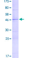 SAMD12 Protein - 12.5% SDS-PAGE of human SAMD12 stained with Coomassie Blue