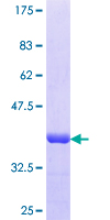 SAMD4A Protein - 12.5% SDS-PAGE Stained with Coomassie Blue.