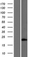SAMD5 Protein - Western validation with an anti-DDK antibody * L: Control HEK293 lysate R: Over-expression lysate