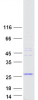 SAMD5 Protein - Purified recombinant protein SAMD5 was analyzed by SDS-PAGE gel and Coomassie Blue Staining