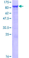 SAMHD1 Protein - 12.5% SDS-PAGE of human SAMHD1 stained with Coomassie Blue