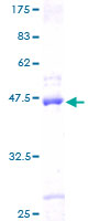 SAP18 Protein - 12.5% SDS-PAGE of human SAP18 stained with Coomassie Blue