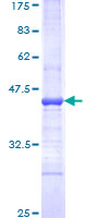 SAP30 Protein - 12.5% SDS-PAGE Stained with Coomassie Blue.