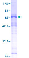 SAP30BP / HTRG Protein - 12.5% SDS-PAGE of human HCNGP stained with Coomassie Blue