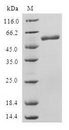 SAP30BP / HTRG Protein - (Tris-Glycine gel) Discontinuous SDS-PAGE (reduced) with 5% enrichment gel and 15% separation gel.