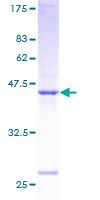 SAR1A / SAR1 Protein - 12.5% SDS-PAGE of human SARA1 stained with Coomassie Blue