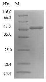 SAR1A / SAR1 Protein - (Tris-Glycine gel) Discontinuous SDS-PAGE (reduced) with 5% enrichment gel and 15% separation gel.