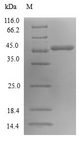 SAR1A / SAR1 Protein - (Tris-Glycine gel) Discontinuous SDS-PAGE (reduced) with 5% enrichment gel and 15% separation gel.