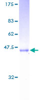 SARA2 / SAR1B Protein - 12.5% SDS-PAGE of human SARA2 stained with Coomassie Blue