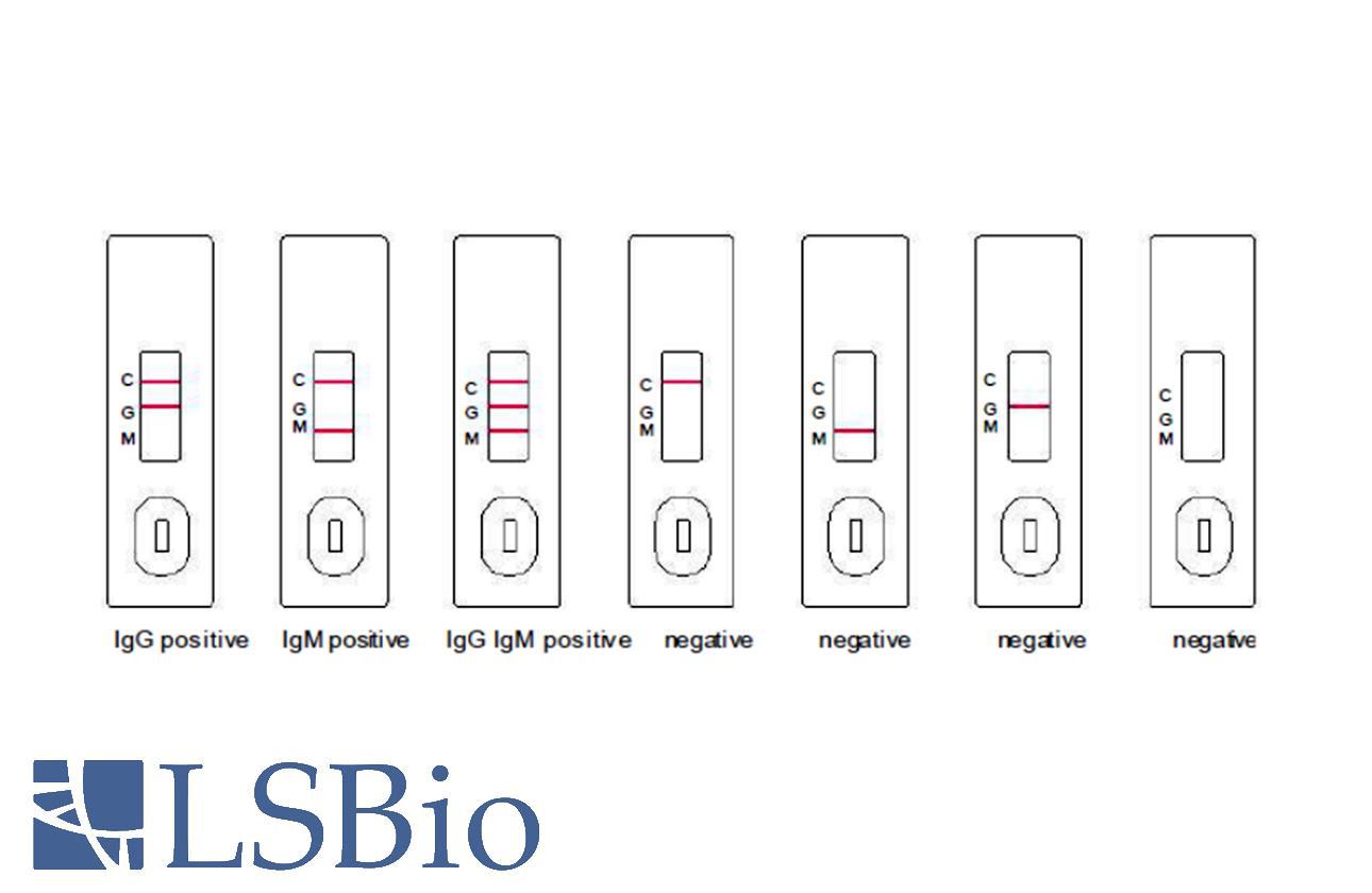 Human SARS-CoV-2 IgG/IgM Antibody Detection Kit (S&N ...