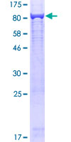 SARS / Serine-tRNA Ligase Protein - 12.5% SDS-PAGE of human SARS stained with Coomassie Blue