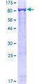 SARS / Serine-tRNA Ligase Protein - 12.5% SDS-PAGE of human SARS stained with Coomassie Blue