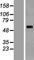 SARS2 / SYS Protein - Western validation with an anti-DDK antibody * L: Control HEK293 lysate R: Over-expression lysate