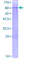 SARS2 / SYS Protein - 12.5% SDS-PAGE of human SARS2 stained with Coomassie Blue