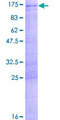 SART1 Protein - 12.5% SDS-PAGE of human SART1 stained with Coomassie Blue