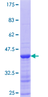 SART1 Protein - 12.5% SDS-PAGE Stained with Coomassie Blue.