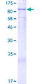 SART2 / DSE Protein - 12.5% SDS-PAGE of human DSE stained with Coomassie Blue