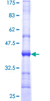 SART2 / DSE Protein - 12.5% SDS-PAGE Stained with Coomassie Blue.