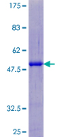 SART3 Protein - 12.5% SDS-PAGE of human SART3 stained with Coomassie Blue