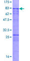 SAS6 / SASS6 Protein - 12.5% SDS-PAGE of human SASS6 stained with Coomassie Blue