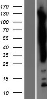 SASH1 Protein - Western validation with an anti-DDK antibody * L: Control HEK293 lysate R: Over-expression lysate