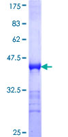 SASH1 Protein - 12.5% SDS-PAGE Stained with Coomassie Blue.