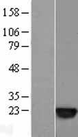 SAT1 / SAT Protein - Western validation with an anti-DDK antibody * L: Control HEK293 lysate R: Over-expression lysate