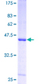 SAT1 / SAT Protein - 12.5% SDS-PAGE of human SAT stained with Coomassie Blue