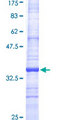 SAT1 / SAT Protein - 12.5% SDS-PAGE Stained with Coomassie Blue.
