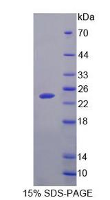 SAT1 / SAT Protein - Recombinant  Spermidine/Spermine N1-Acetyltransferase 1 By SDS-PAGE