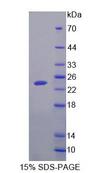 SAT1 / SAT Protein - Recombinant  Spermidine/Spermine N1-Acetyltransferase 1 By SDS-PAGE