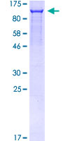 SATB1 Protein - 12.5% SDS-PAGE of human SATB1 stained with Coomassie Blue