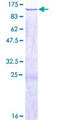 SATB2 Protein - 12.5% SDS-PAGE of human SATB2 stained with Coomassie Blue