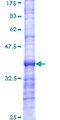 SATB2 Protein - 12.5% SDS-PAGE Stained with Coomassie Blue.
