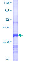 SBF2 Protein - 12.5% SDS-PAGE Stained with Coomassie Blue.