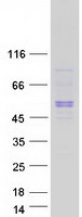 SBK1 Protein - Purified recombinant protein SBK1 was analyzed by SDS-PAGE gel and Coomassie Blue Staining