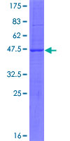 SBNO1 Protein - 12.5% SDS-PAGE of human SBNO1 stained with Coomassie Blue