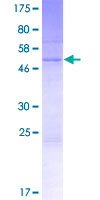 SBSN Protein - 12.5% SDS-PAGE of human SBSN stained with Coomassie Blue