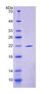 SBSN Protein - Recombinant  Suprabasin By SDS-PAGE