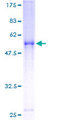 SC4MOL Protein - 12.5% SDS-PAGE of human SC4MOL stained with Coomassie Blue