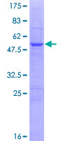 SC5D / ERG3 Protein - 12.5% SDS-PAGE of human SC5DL stained with Coomassie Blue