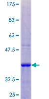 SCA2 / LY6E Protein - 12.5% SDS-PAGE of human LY6E stained with Coomassie Blue