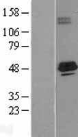 SCAD / ACADS Protein - Western validation with an anti-DDK antibody * L: Control HEK293 lysate R: Over-expression lysate