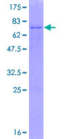 SCAD / ACADS Protein - 12.5% SDS-PAGE of human ACADS stained with Coomassie Blue