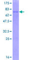 SCAD / ACADS Protein - 12.5% SDS-PAGE of human ACADS stained with Coomassie Blue