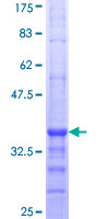 SCAD / ACADS Protein - 12.5% SDS-PAGE Stained with Coomassie Blue.