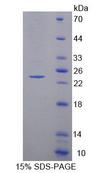 SCAD / ACADS Protein - Recombinant Acyl Coenzyme A Dehydrogenase, C2-To-C3 Short Chain (ACADS) by SDS-PAGE