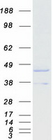 SCAD / ACADS Protein - Purified recombinant protein ACADS was analyzed by SDS-PAGE gel and Coomassie Blue Staining